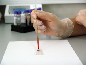 анализы крови на гормоны